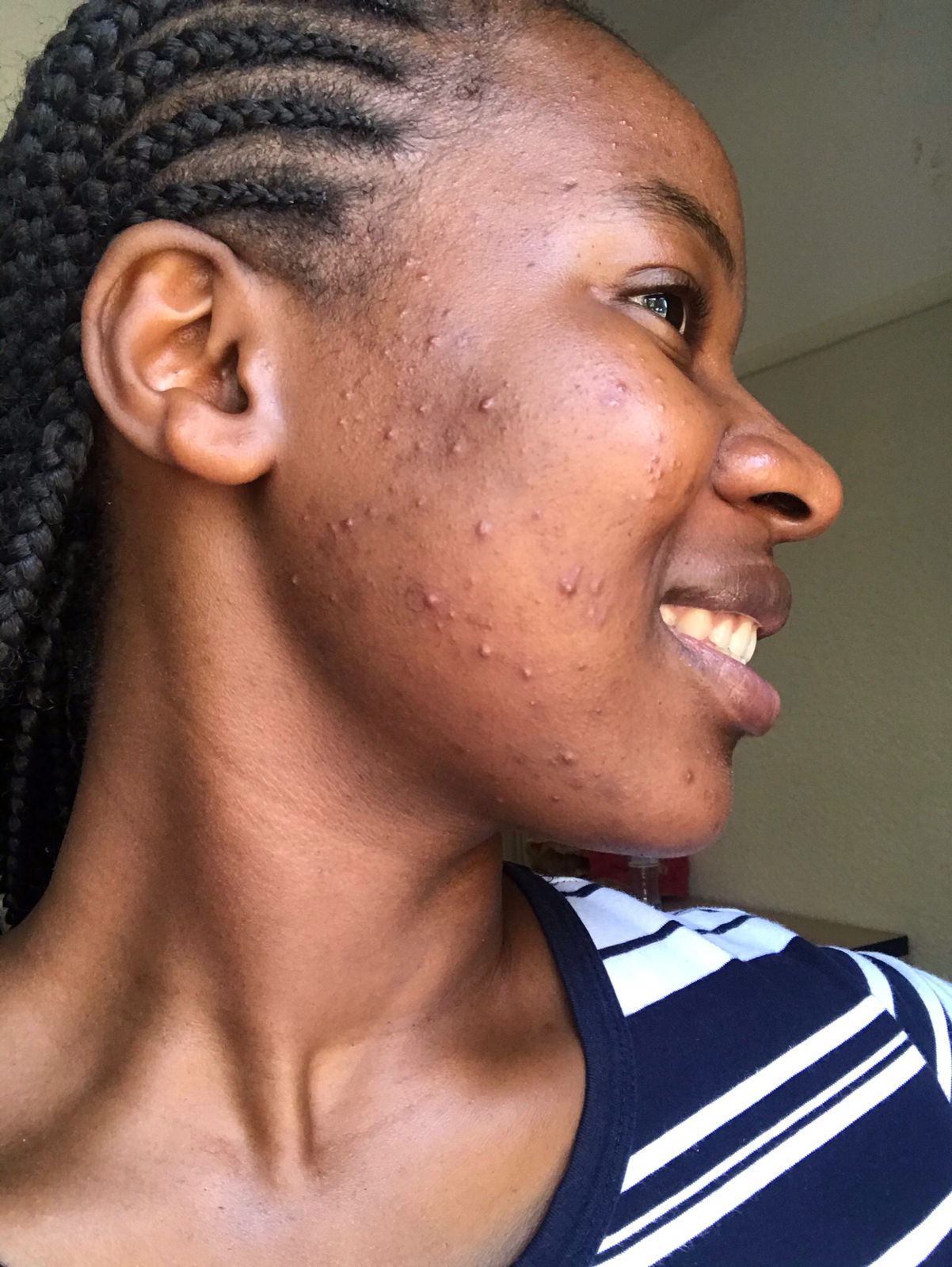 Hair Condition Before Treatment