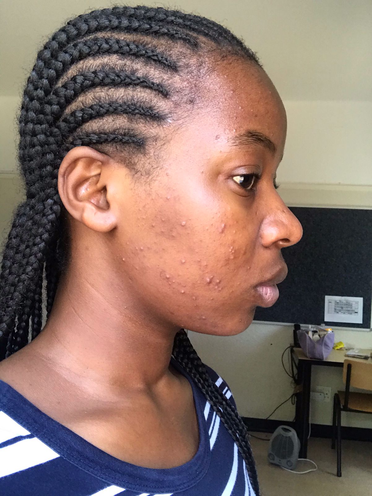 Face skin before treatment