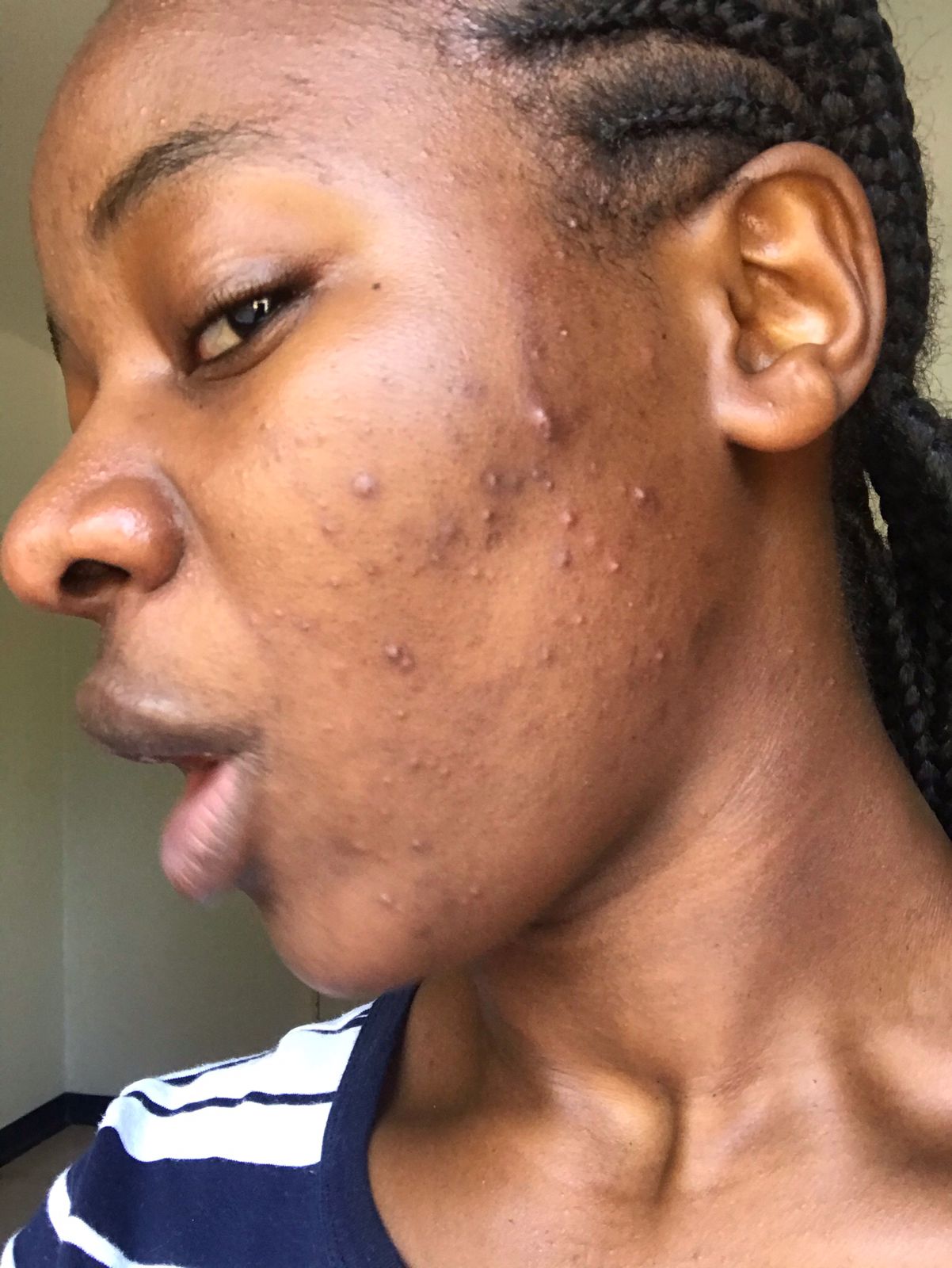 Face skin before treatment